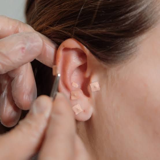 Agenda AURICULOTERAPIA